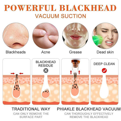 Blackhead & Whitehead Extractor